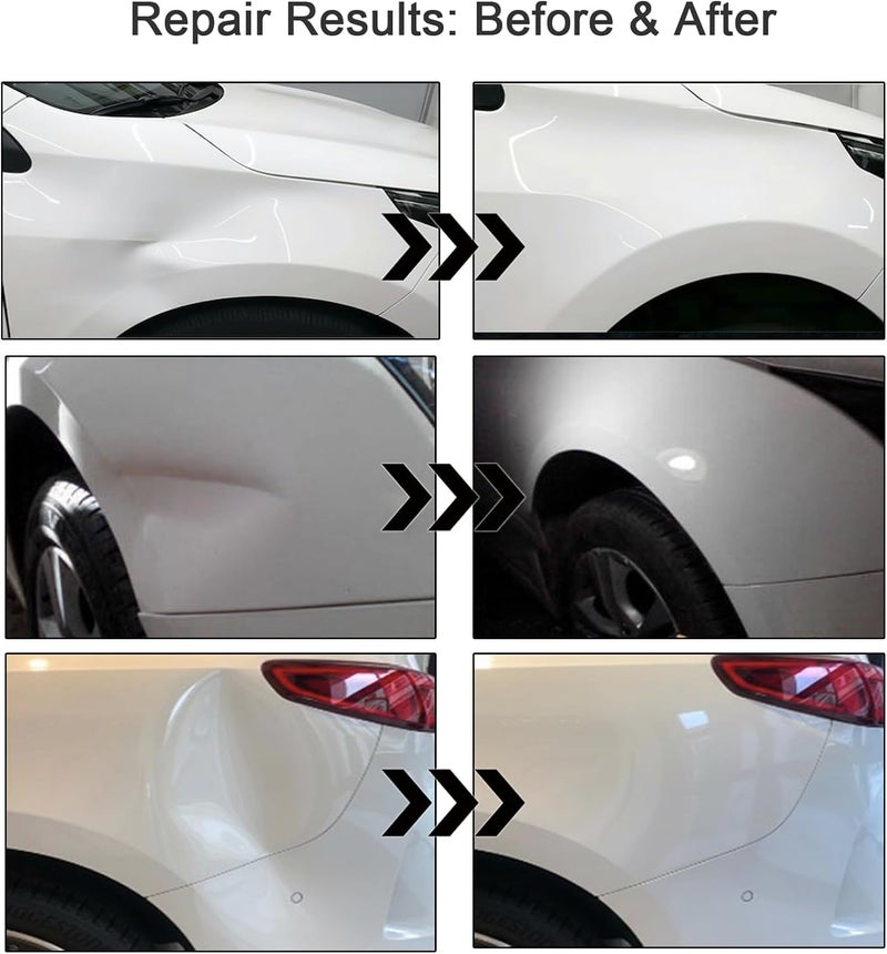 Ibexrun Dent Puller Kit for Car, 3-Pack Paintless Car Dent Repair Remover Kit, Dent Removal Tool with Suction Cup for Auto Body Hood/Door, No Glue No Scratch - Image 2